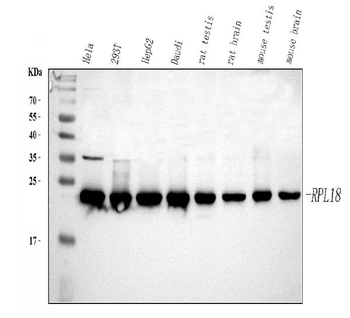 Anti-RPL18 Antibody