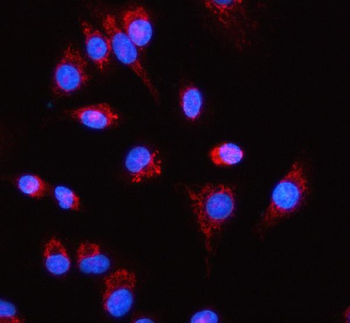 Anti-RPL18 Antibody