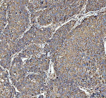 Anti-RPL18 Antibody