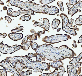 Anti-RPL18 Antibody