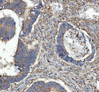 Anti-RPL18 Antibody