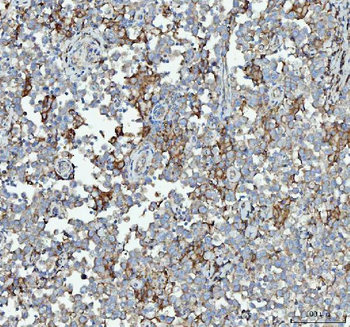 Anti-RPL18 Antibody