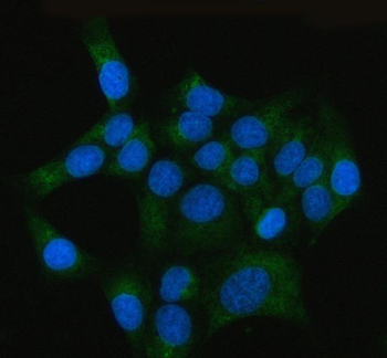 Anti-RRBP1 Antibody