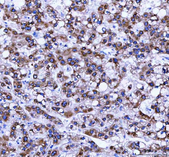 Anti-RRBP1 Antibody