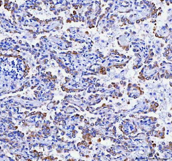 Anti-RRBP1 Antibody