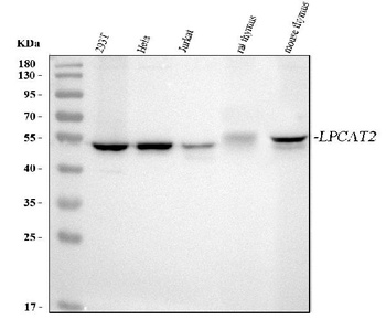 Anti-LPCAT2 Antibody