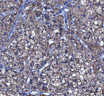 Anti-LIN7C Antibody