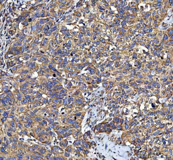 Anti-LIN7C Antibody