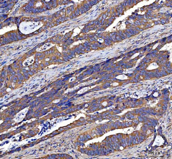 Anti-LIN7C Antibody