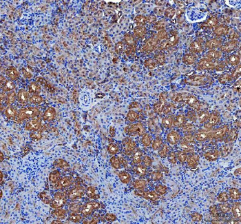 Anti-LIN7C Antibody