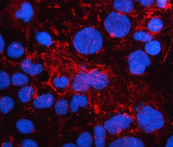 Anti-LAD1 Antibody