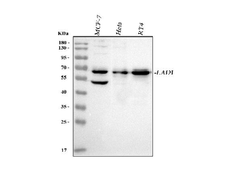 Anti-LAD1 Antibody