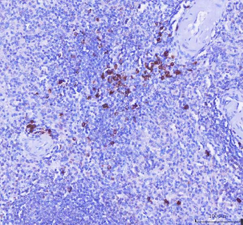 Anti-MZB1 Antibody