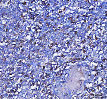 Anti-MZB1 Antibody