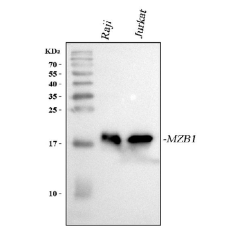 Anti-MZB1 Antibody