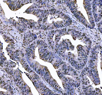 Anti-L3MBTL2 Antibody