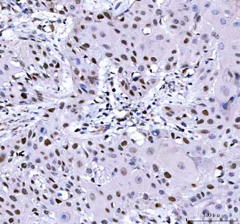 Anti-L3MBTL2 Antibody