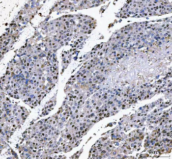 Anti-L3MBTL2 Antibody