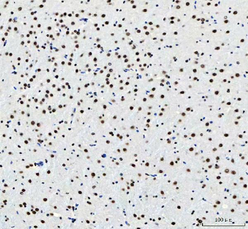 Anti-CROP/LUC7L3 Antibody