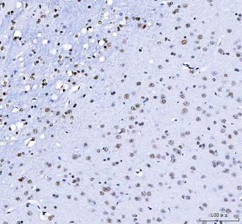 Anti-CROP/LUC7L3 Antibody