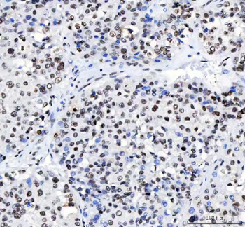 Anti-CROP/LUC7L3 Antibody
