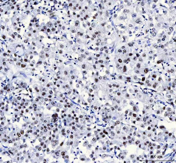 Anti-CROP/LUC7L3 Antibody