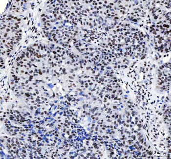 Anti-CROP/LUC7L3 Antibody