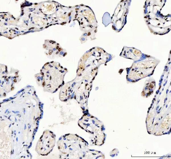 Anti-CROP/LUC7L3 Antibody