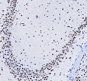 Anti-CROP/LUC7L3 Antibody