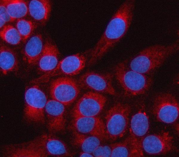 Anti-LRRC59 Antibody