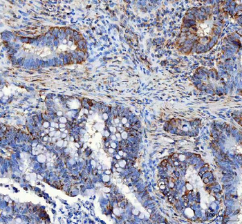 Anti-LRRC59 Antibody