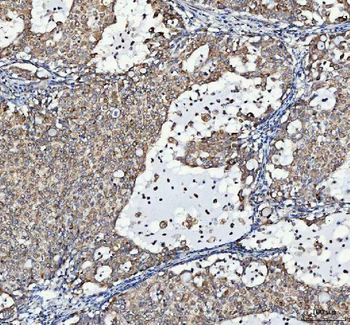 Anti-LRRC59 Antibody