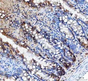 Anti-LRRC59 Antibody
