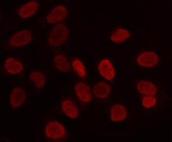 LRIG2 Rabbit Polyclonal Antibody