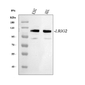 LRIG2 Rabbit Polyclonal Antibody