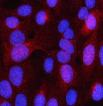 Anti-LHPP Antibody