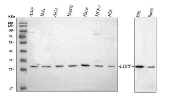 Anti-LHPP Antibody