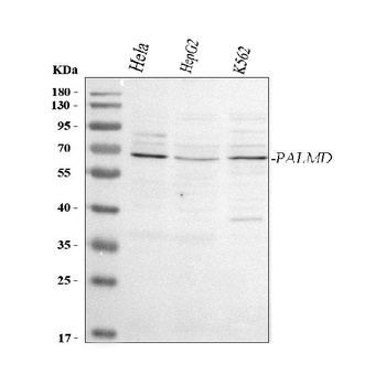 Anti-PALMD Antibody