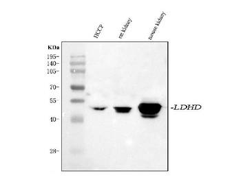 Anti-LDHD Antibody