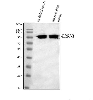 Anti-LRRN1 Antibody