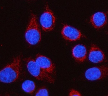 Anti-LGI4 Antibody