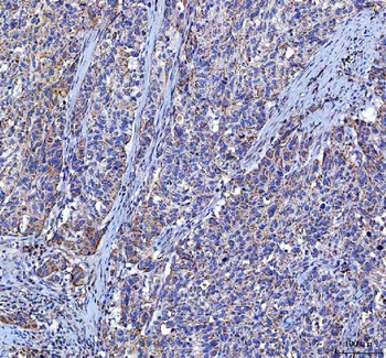 Anti-LGI4 Antibody