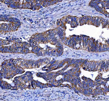 Anti-LGI4 Antibody