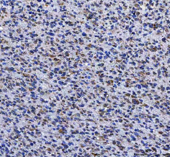 Anti-LGI4 Antibody