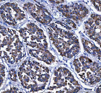 Anti-LGI4 Antibody