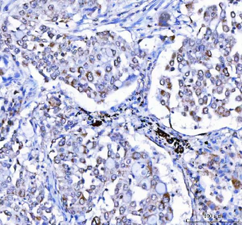 Anti-LGI4 Antibody