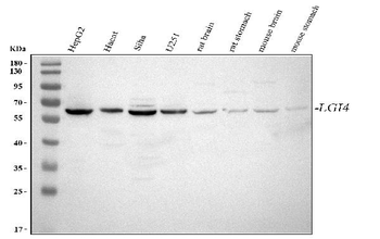 Anti-LGI4 Antibody