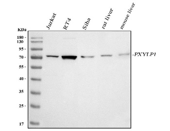 Anti-PXYLP1 Antibody