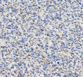 LDAH Antibody