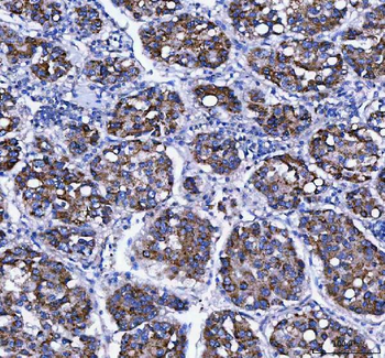 LDAH Antibody